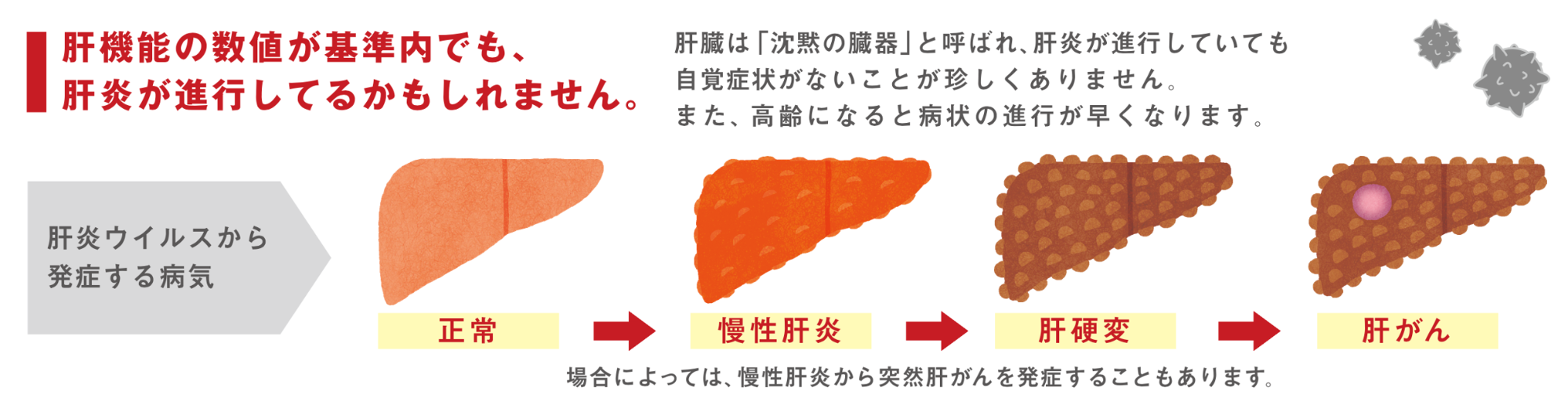 肝臓の症状の進行状況のイラスト